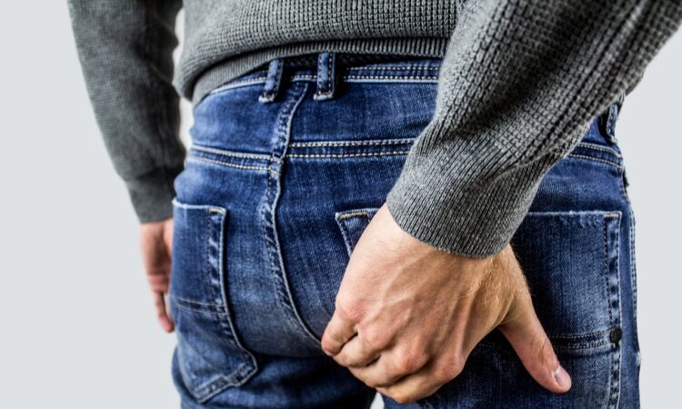 Wie sehen Hämorrhoiden aus?