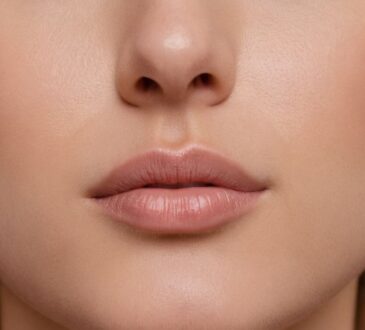 Lippen aufspritzen: Vorher-Nachher-Ergebnisse und Erfahrungen im Überblick