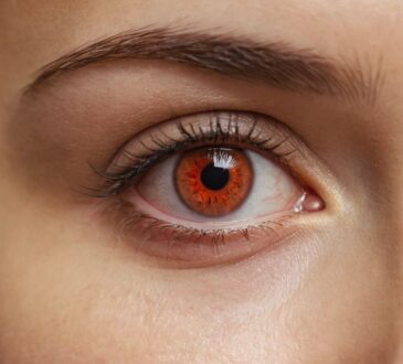 Blut im Auge nach Schlaganfall: Ursachen, Risiken und Behandlungsmöglichkeiten