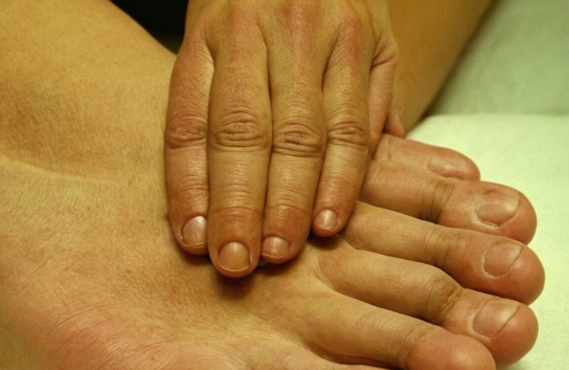 Hand-Mund-Fuß-Erkrankung bei Erwachsenen: Symptome, Ursachen und Behandlungsmöglichkeiten