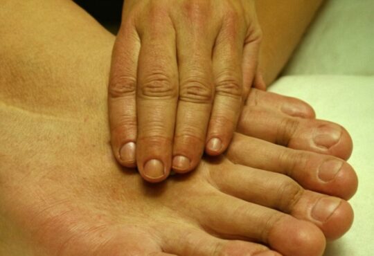 Hand-Mund-Fuß-Erkrankung bei Erwachsenen: Symptome, Ursachen und Behandlungsmöglichkeiten